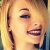 bracesmegan